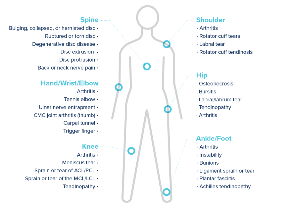 conditions that Regenexx has a surgery alternative for